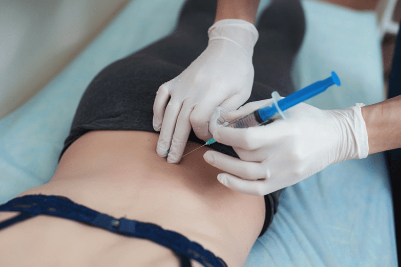 Blockade during lumbar osteochondrosis