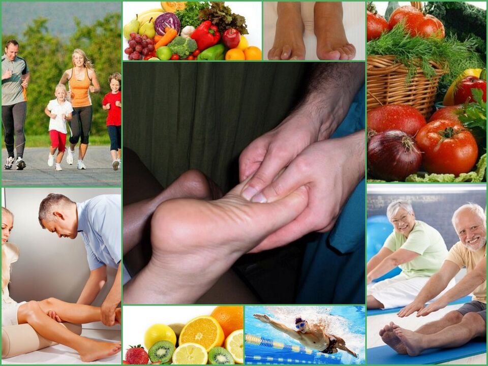 Arthritis of the knee joints